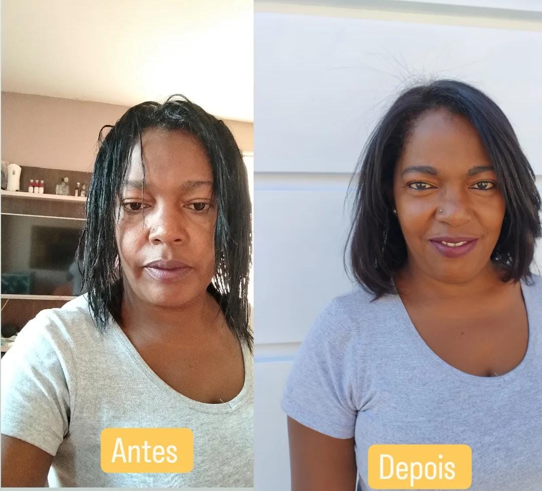 Antes e Depois - Resultado Real